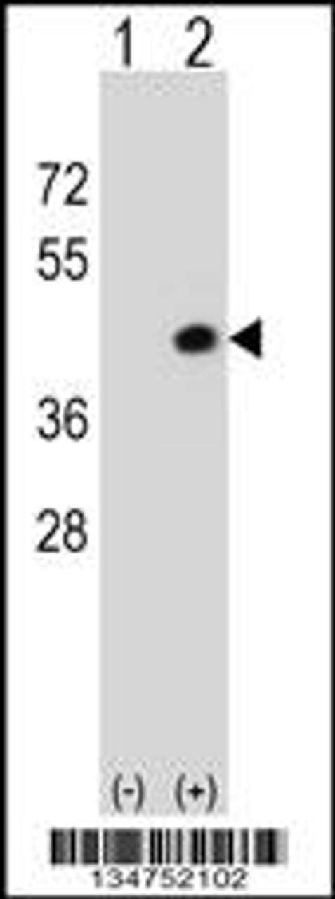 Western blot analysis of Dapk2 using rabbit polyclonal Mouse Dapk2 Antibody using 293 cell lysates (2 ug/lane) either nontransfected (Lane 1) or transiently transfected (Lane 2) with the Dapk2 gene.