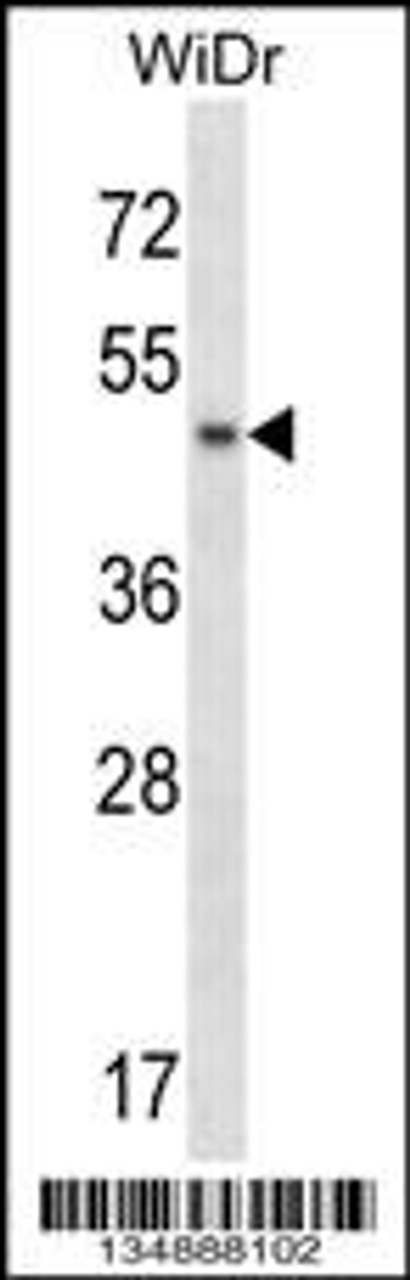 Western blot analysis in WiDr cell line lysates (35ug/lane) .