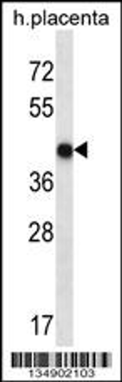 Western blot analysis in human placenta tissue lysates (35ug/lane) .