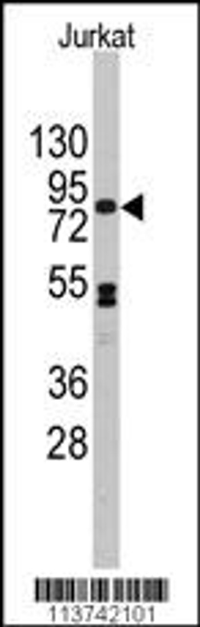 Western blot analysis of anti-CDH12 Antibody in Jurkat cell line lysates (35ug/lane) .