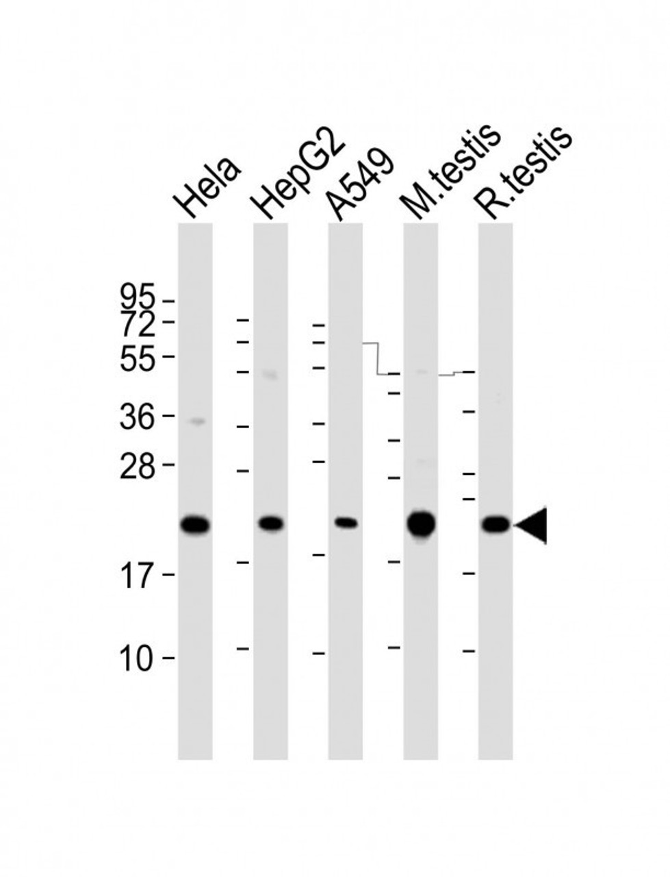 Western Blot at 1:2000 dilution Lane 1: Hela whole cell lysate Lane 2: HepG2 whole cell lysate Lane 3: A549 whole cell lysate Lane 4: mouse testis lysate Lane 5: rat testis lysate Lysates/proteins at 20 ug per lane.