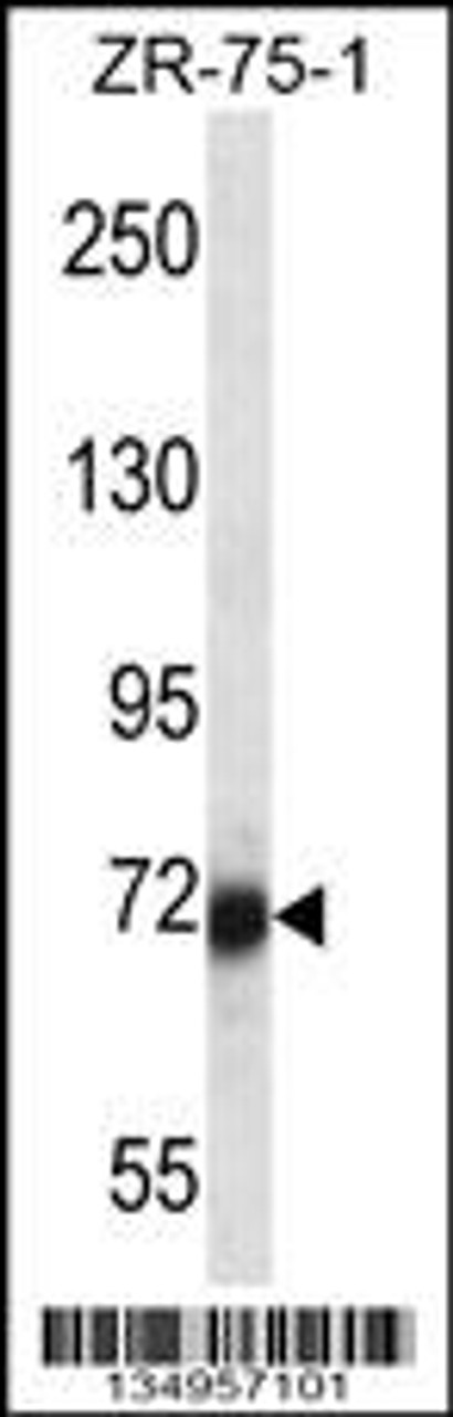 Western blot analysis in ZR-75-1 cell line lysates (35ug/lane) .