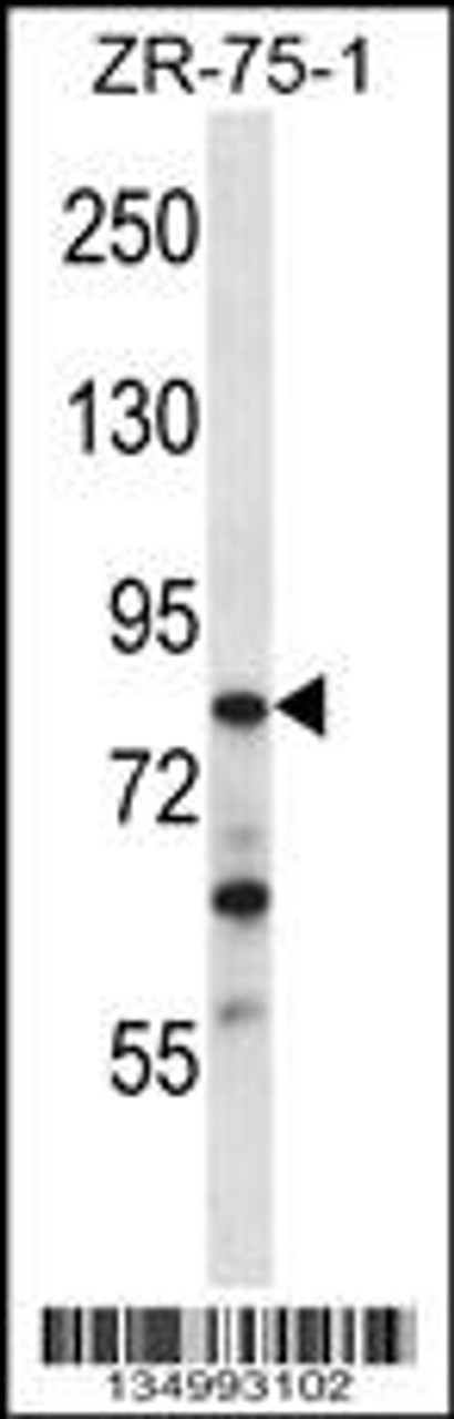 Western blot analysis in ZR-75-1 cell line lysates (35ug/lane) .