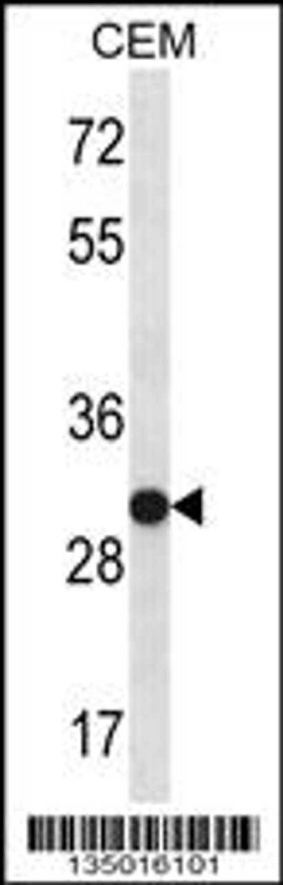 Western blot analysis in CEM cell line lysates (35ug/lane) .