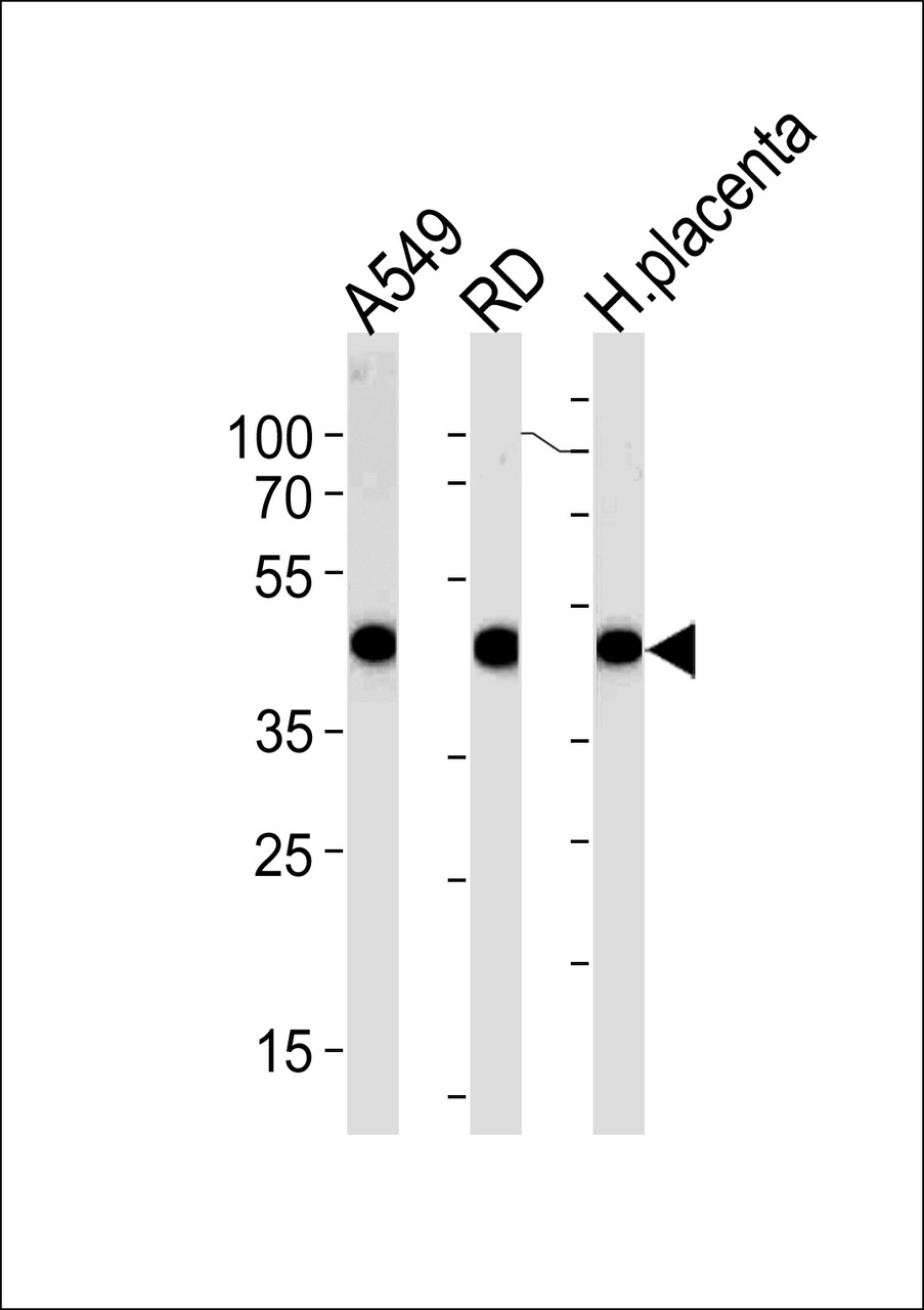 Western blot analysis in A549, RD cell line and human placenta lysates (35ug/lane) .This demonstrates the ACTA1/alpha -actin antibody detected the ACTA1/alpha -actin protein (arrow) .