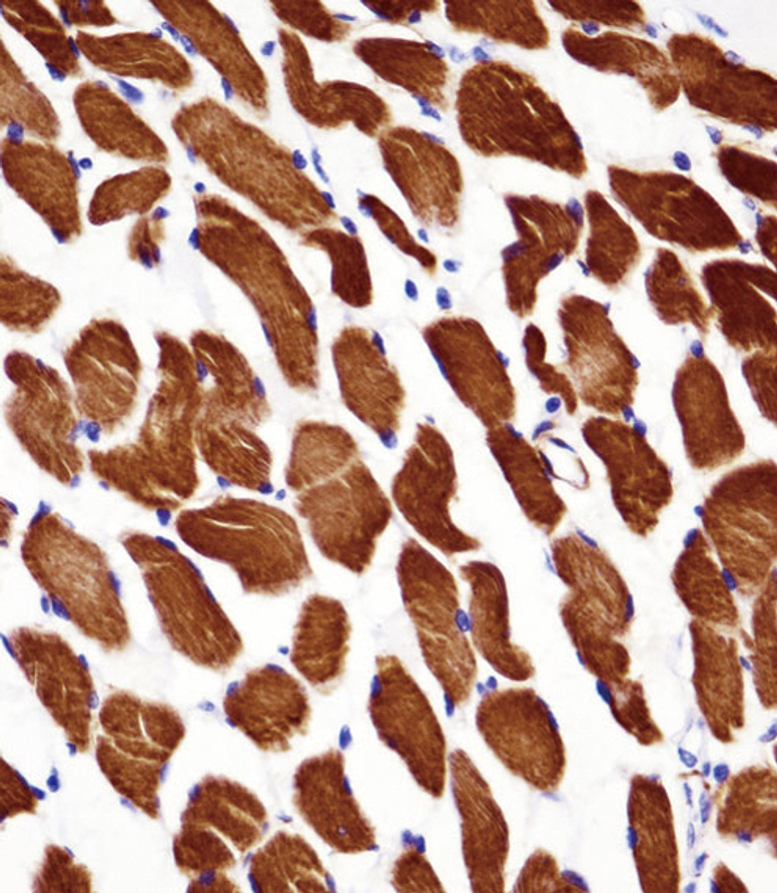 ACTA1/alpha -actin Antibody immunohistochemistry analysis in formalin fixed and paraffin embedded human skeletal muscle followed by peroxidase conjugation of the secondary antibody and DAB staining.