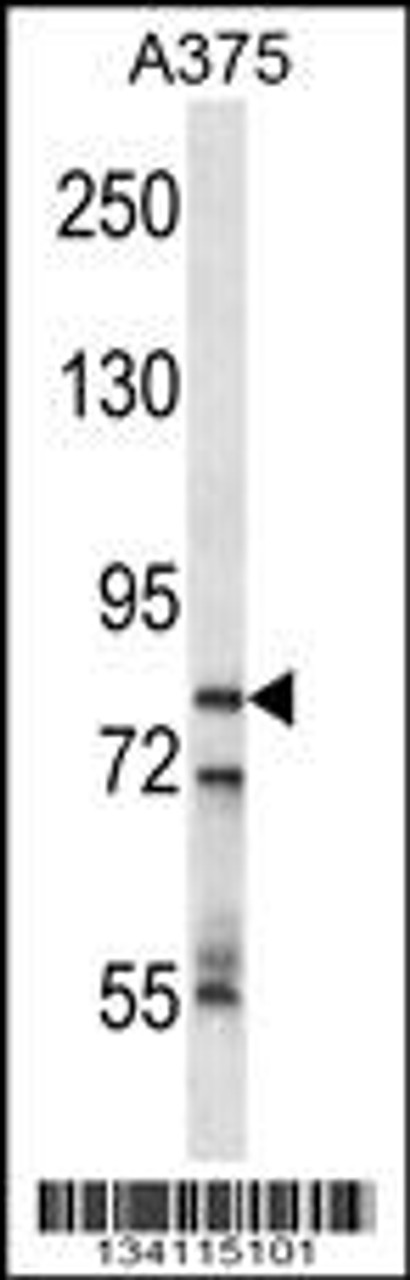 Western blot analysis in A375 cell line lysates (35ug/lane) .