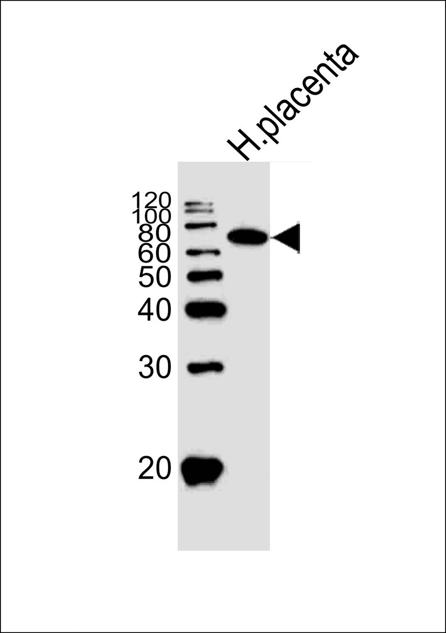 Western blot analysis of lysate from human placenta tissue lysate, using ALPI Antibody at 1:1000.