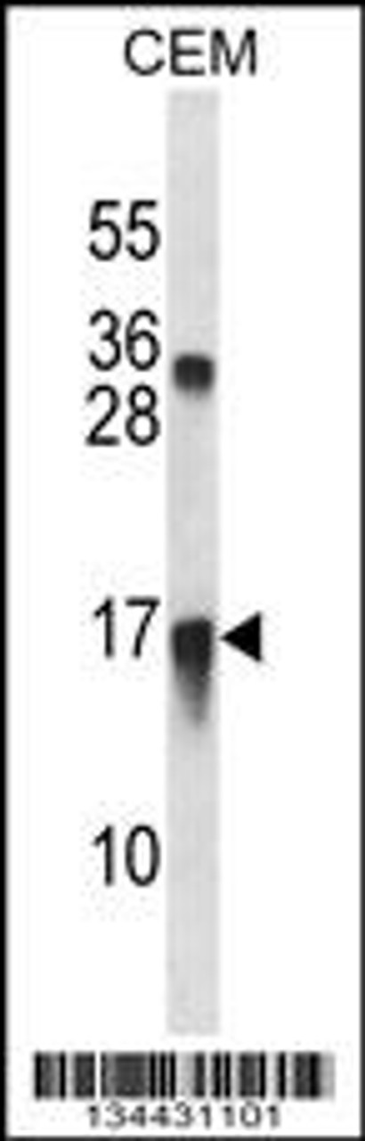 Western blot analysis in CEM cell line lysates (35ug/lane) .