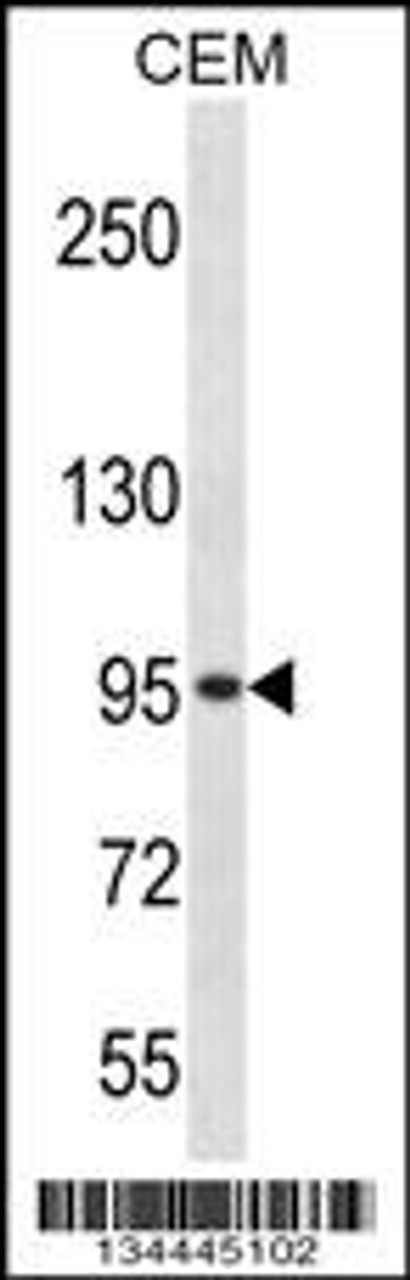 Western blot analysis in CEM cell line lysates (35ug/lane) .