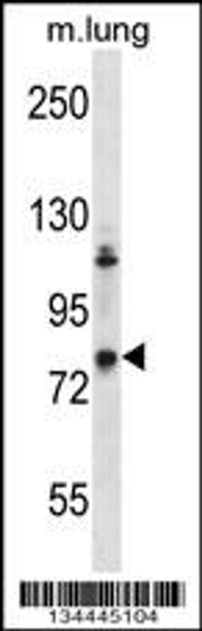 Western blot analysis in mouse lung tissue lysates (35ug/lane) .