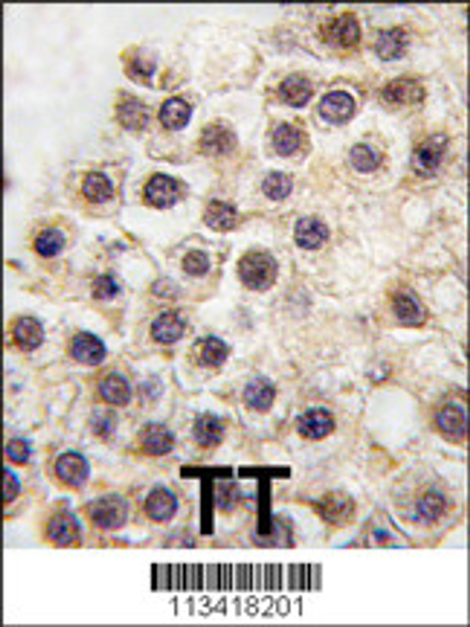 Formalin-fixed and paraffin-embedded human testis tissue reacted with ARIDB3 antibody, which was peroxidase-conjugated to the secondary antibody, followed by DAB staining.