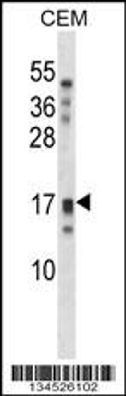 Western blot analysis in CEM cell line lysates (35ug/lane) .
