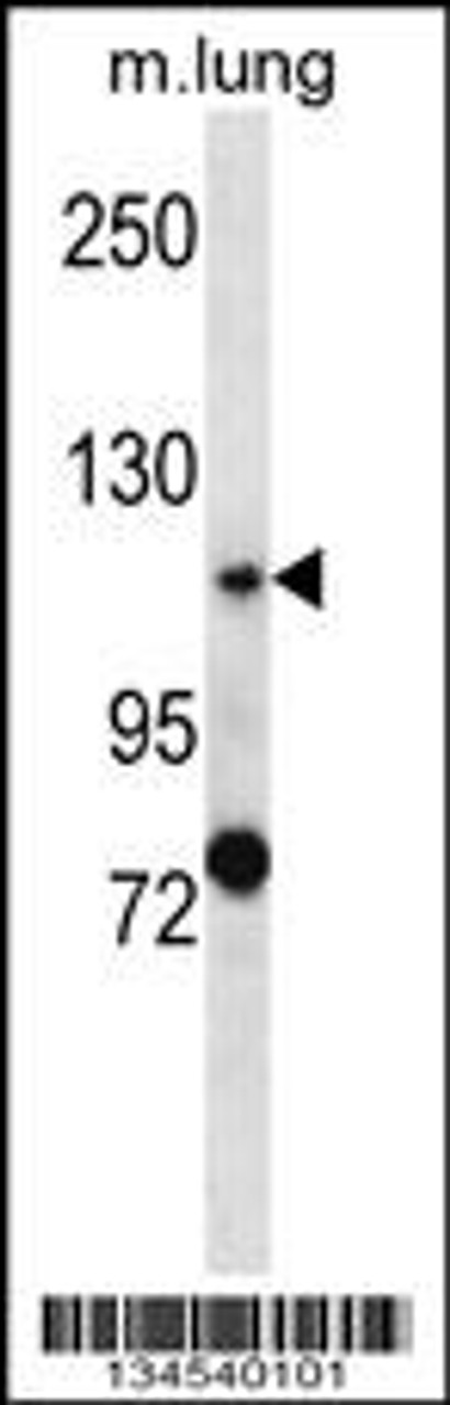 Western blot analysis in mouse lung tissue lysates (35ug/lane) .