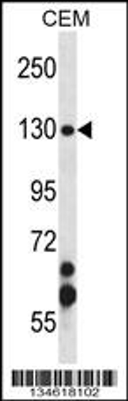 Western blot analysis in CEM cell line lysates (35ug/lane) .