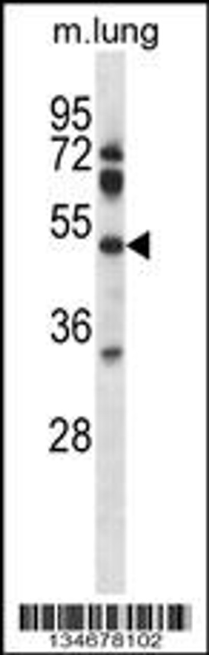 Western blot analysis in mouse lung tissue lysates (35ug/lane) .