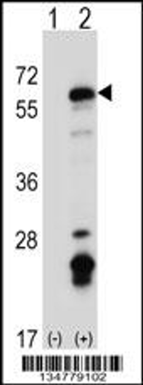 Western blot analysis of Fyn using rabbit polyclonal Mouse Fyn Antibody using 293 cell lysates (2 ug/lane) either nontransfected (Lane 1) or transiently transfected (Lane 2) with the Fyn gene.