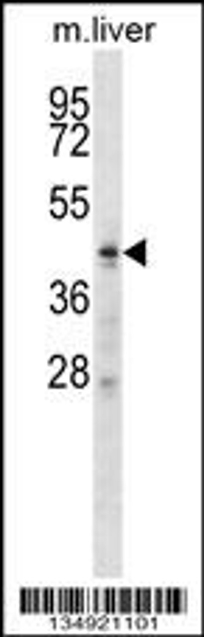 Western blot analysis in mouse liver tissue lysates (35ug/lane) .