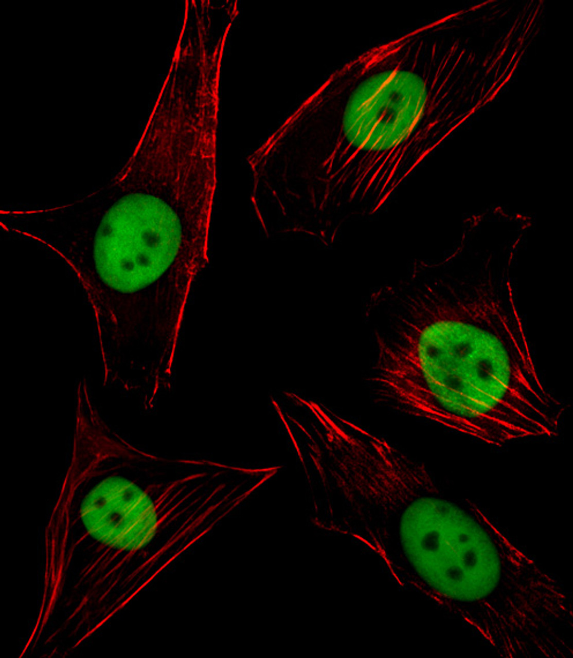 Fluorescent image of NIH/3T3 cell stained with SPI1 Antibody .NIH/3T3 cells were fixed with 4% PFA (20 min) , permeabilized with Triton X-100 (0.1%, 10 min) , then incubated with SPI1 primary antibody (1:25) . For secondary antibody, Alexa Fluor 488 conjugated donkey anti-rabbit antibody (green) was used (1:400) .Cytoplasmic actin was counterstained with Alexa Fluor 555 (red) conjugated Phalloidin (7units/ml) . SPI1 immunoreactivity is localized to Nucleus significantly.