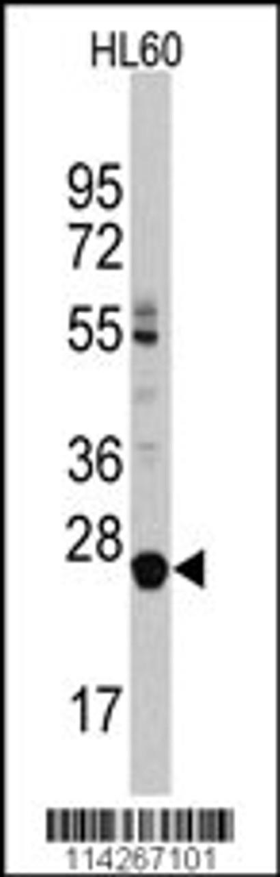 Western blot analysis of LIN28B Antibody in HL60 cell line lysates (35ug/lane)