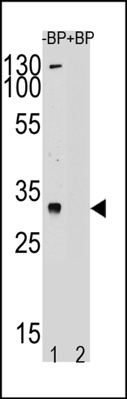 Western blot analysis of TSPY Antibody pre-incubated without (lane 1) and with (lane 2) blocking peptide in LNCAP cell line lysate. TSPY was detected using the purified TSPY Antibody.