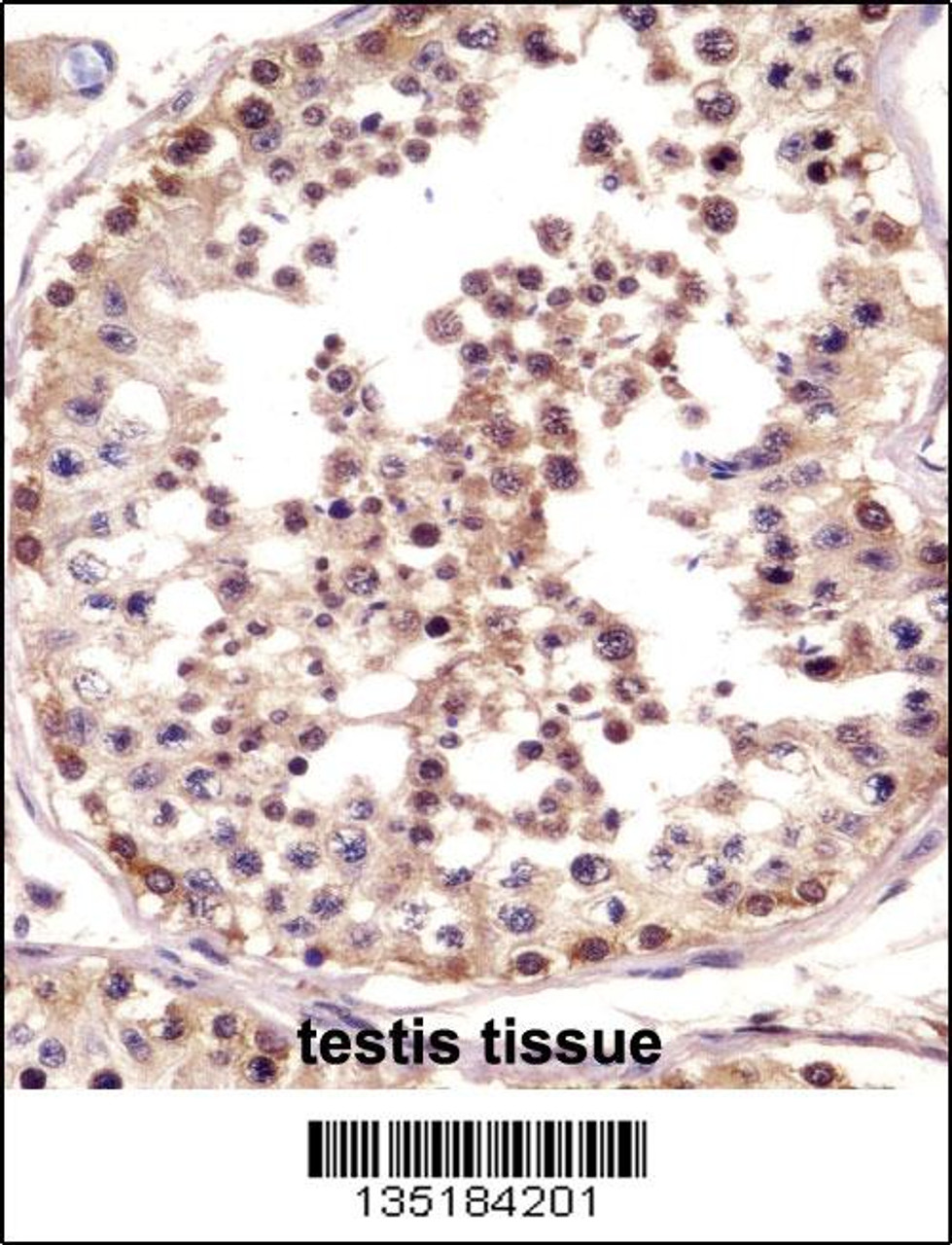 TSPY Antibody immunohistochemistry analysis in formalin fixed and paraffin embedded human testis tissue followed by peroxidase conjugation of the secondary antibody and DAB staining.