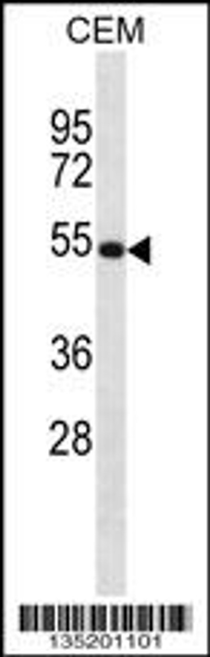 Western blot analysis in CEM cell line lysates (35ug/lane) .