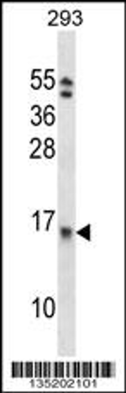 Western blot analysis in 293 cell line lysates (35ug/lane) .