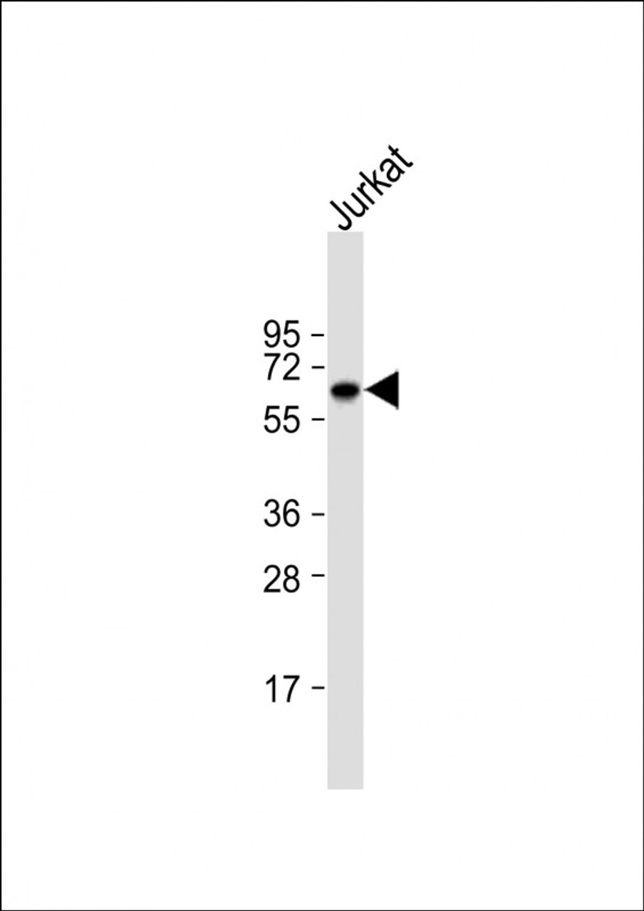 Western Blot at 1:1000 dilution + Jurkat whole cell lysate Lysates/proteins at 20 ug per lane.