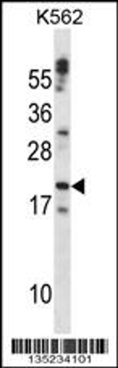 Western blot analysis in K562 cell line lysates (35ug/lane) .