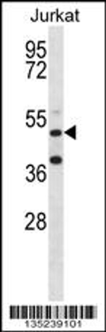 Western blot analysis in Jurkat cell line lysates (35ug/lane) .