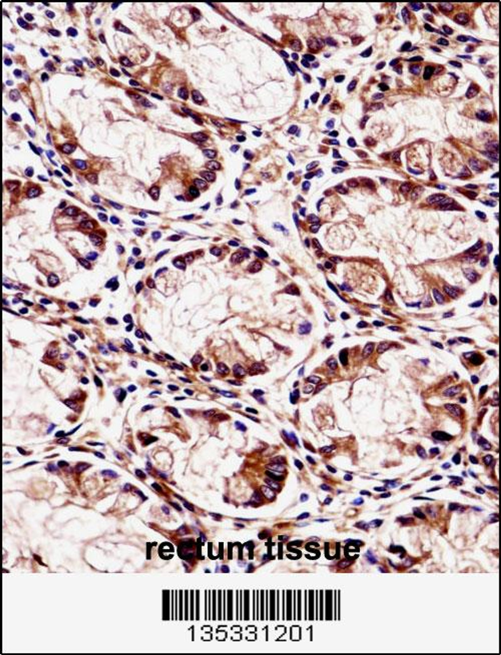 FXYD5 Antibody immunohistochemistry analysis in formalin fixed and paraffin embedded human rectum tissue followed by peroxidase conjugation of the secondary antibody and DAB staining.