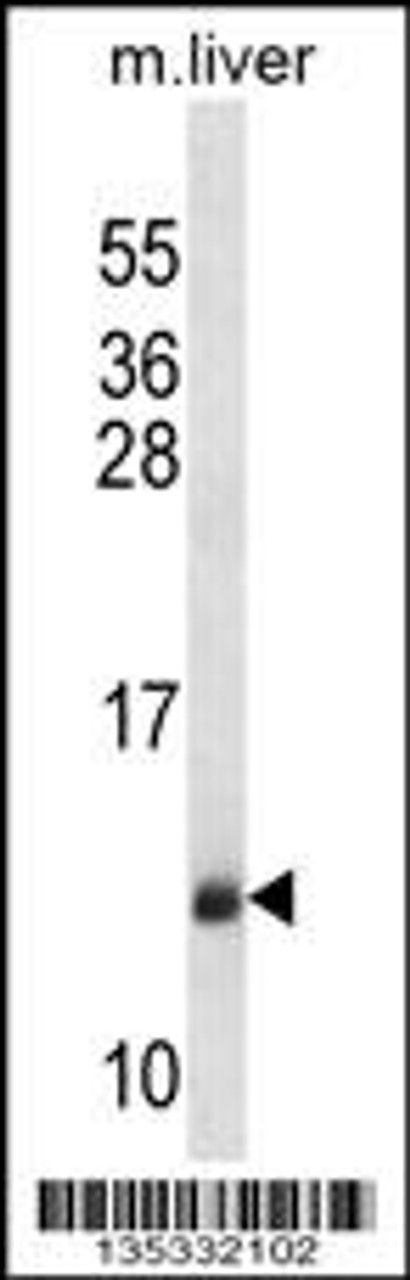 Western blot analysis in mouse liver tissue lysates (35ug/lane) .