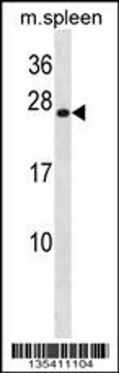 Western blot analysis in mouse spleen tissue lysates (35ug/lane) .