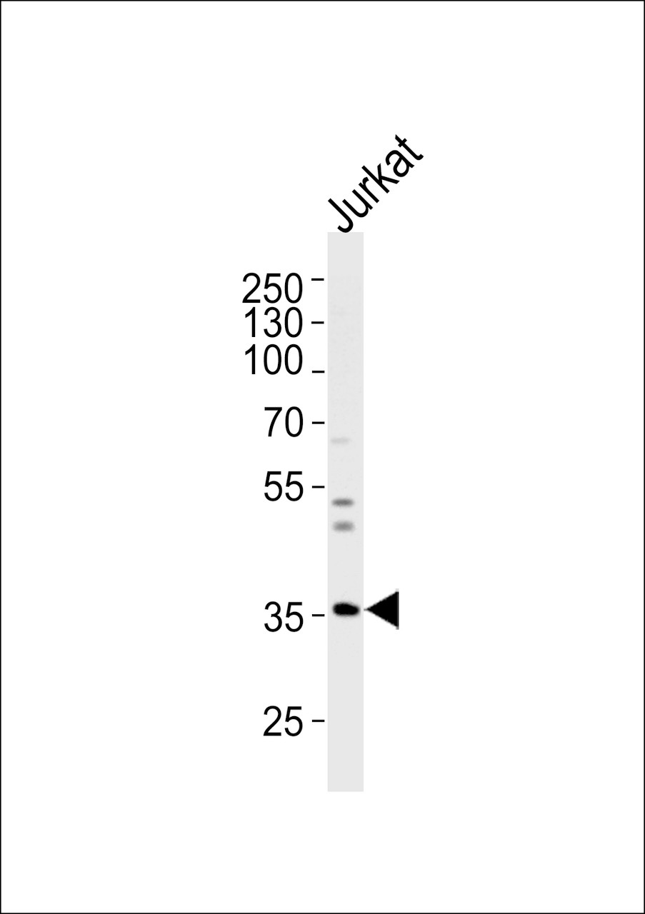 Western blot analysis of lysate from Jurkat cell line, using GLRB Antibody at 1:1000 at each lane.