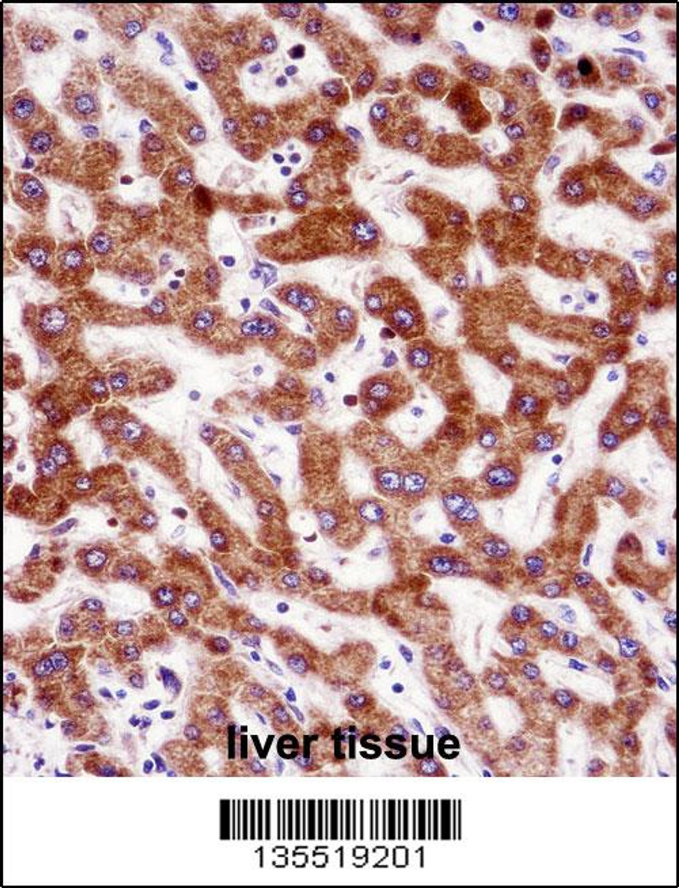 IHH Antibody immunohistochemistry analysis in formalin fixed and paraffin embedded human liver tissue followed by peroxidase conjugation of the secondary antibody and DAB staining.