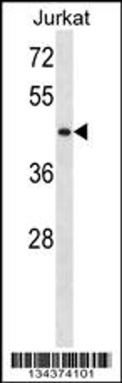 Western blot analysis in Jurkat cell line lysates (35ug/lane) .