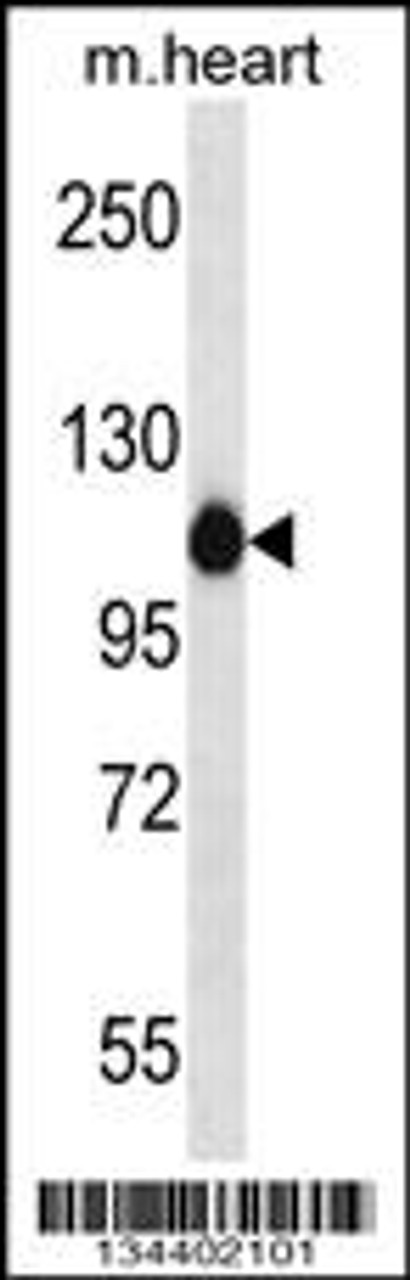 Western blot analysis in mouse heart tissue lysates (35ug/lane) .