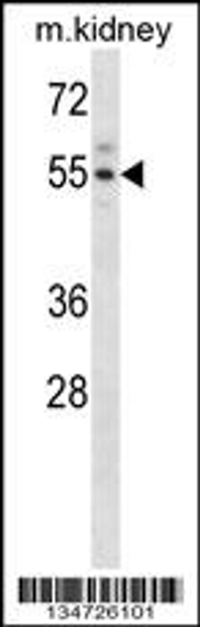 Western blot analysis in mouse kidney tissue lysates (35ug/lane) .