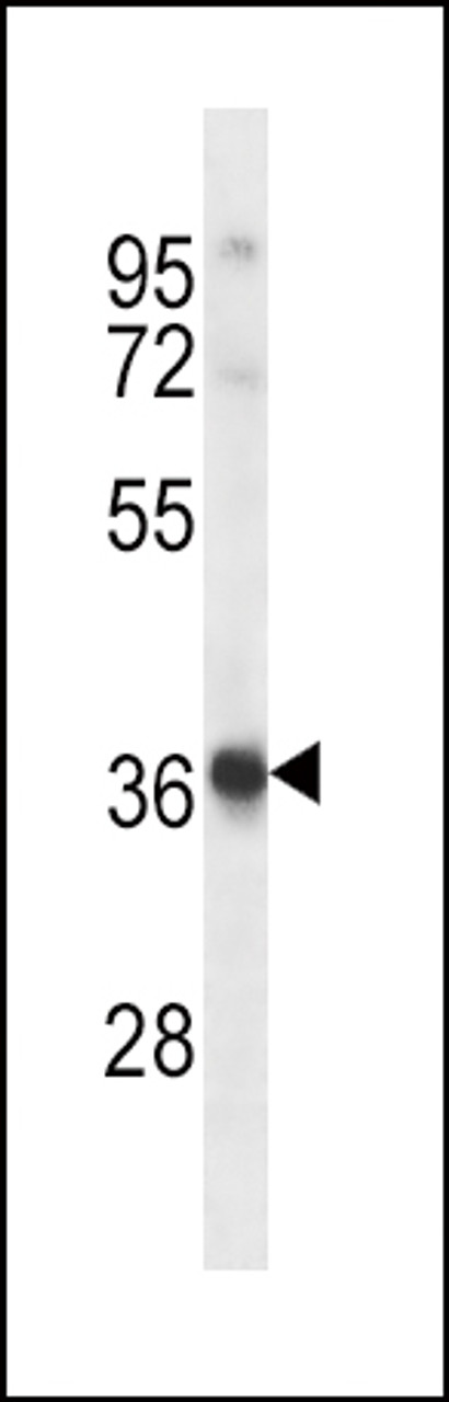 Western blot analysis in Uterus tissue lysates (35ug/lane) .