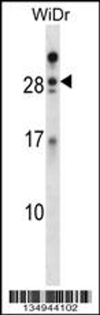 Western blot analysis in WiDr cell line lysates (35ug/lane) .