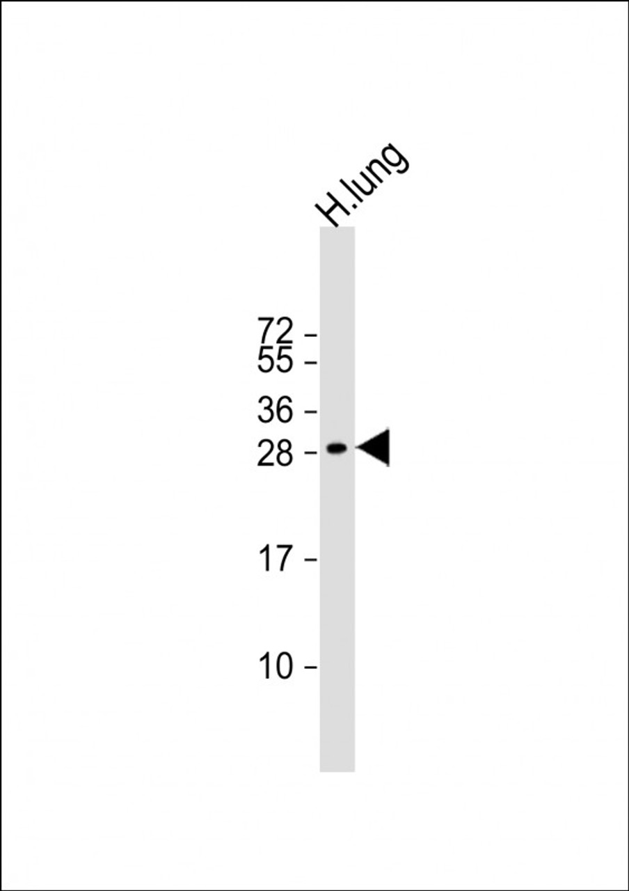 Western Blot at 1:2000 dilution + human lung lysate Lysates/proteins at 20 ug per lane.