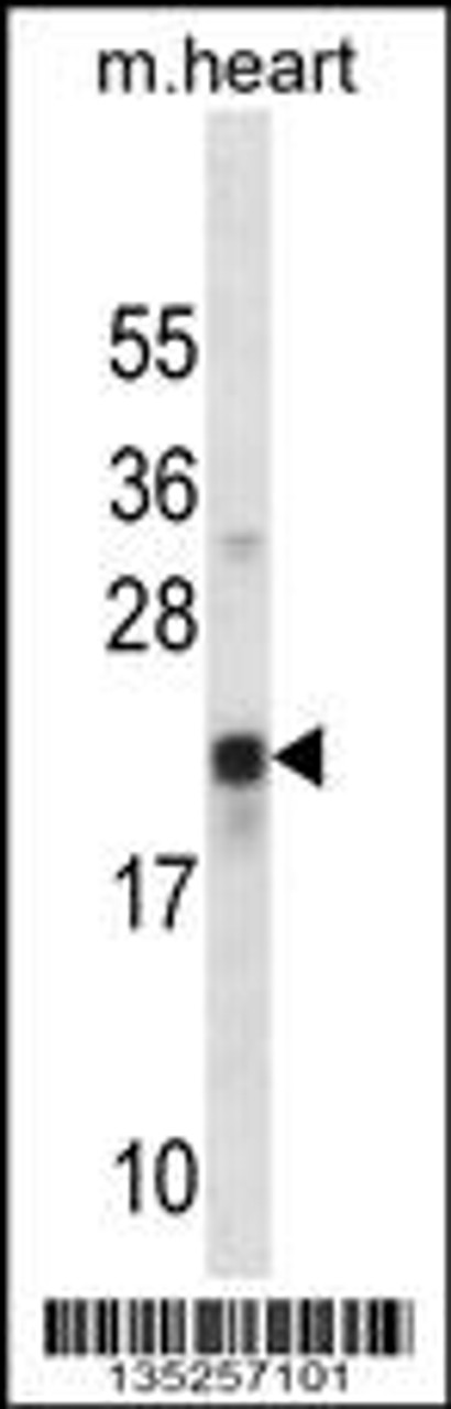 Western blot analysis in mouse heart tissue lysates (35ug/lane) .