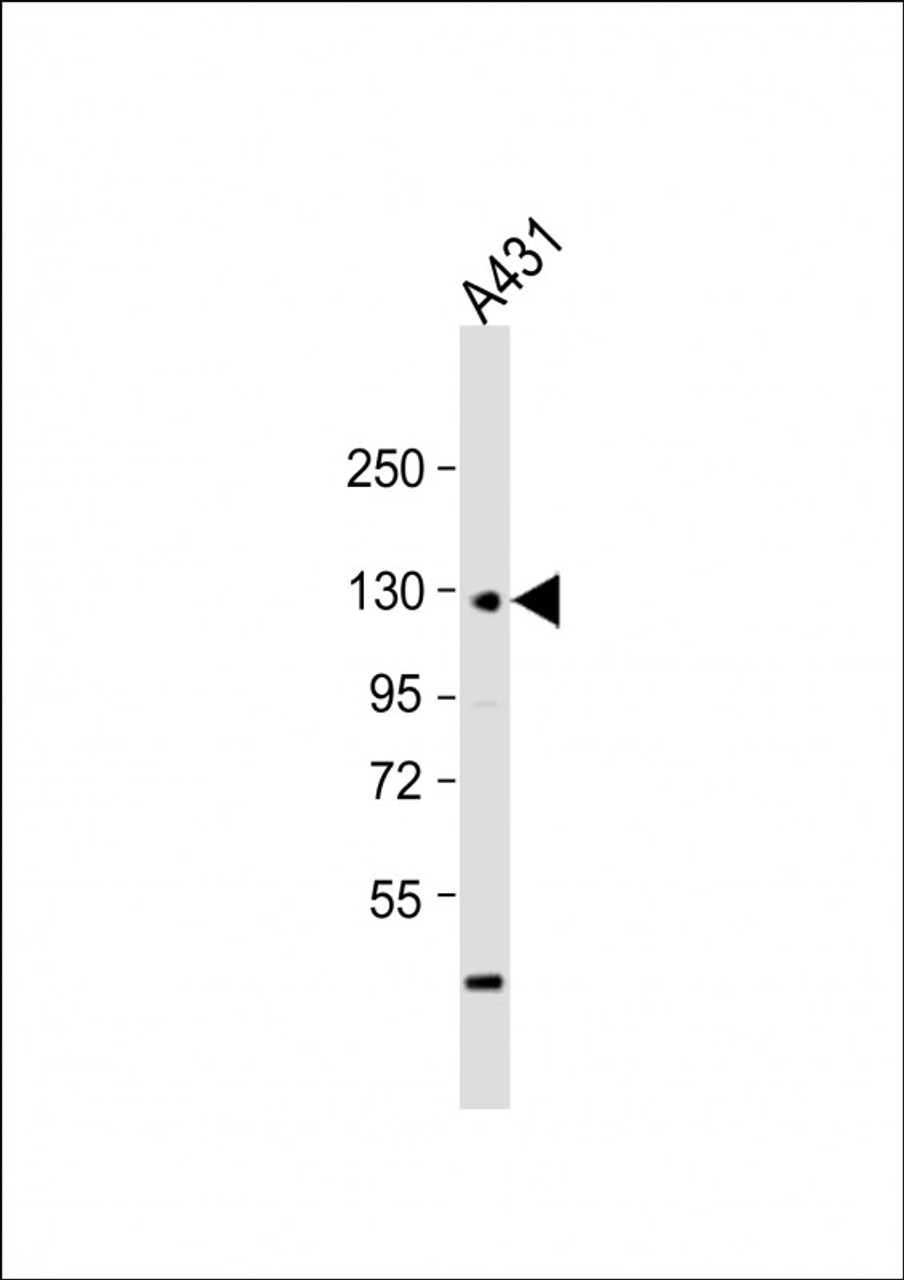 Western Blot at 1:1000 dilution + A431 whole cell lysate Lysates/proteins at 20 ug per lane.