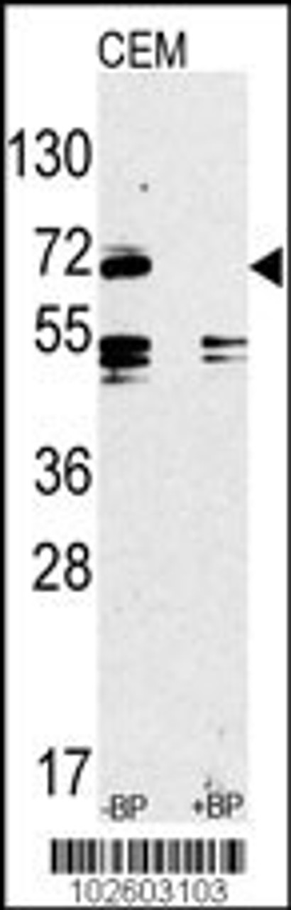 Western Blot in CEM cell line lysate. TLR2-V735 (arrow) was detected using the purified Pab.