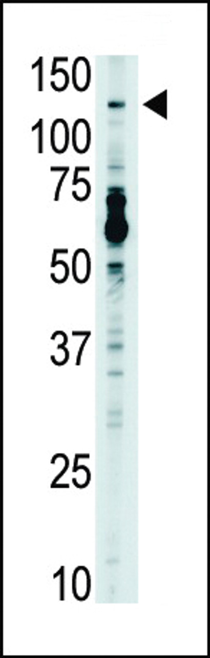 Antibody is used in Western blot to detect TLR7 in mouse liver tissue lysate.