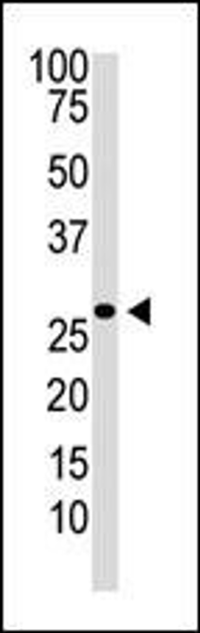 Antibody is used in Western blot to detect DKK2 in Jurkat cell lysate.