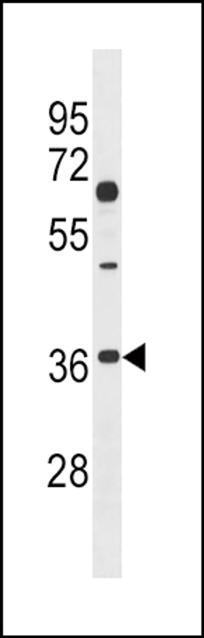 Western blot analysis in 293 cell line lysates (35ug/lane) .
