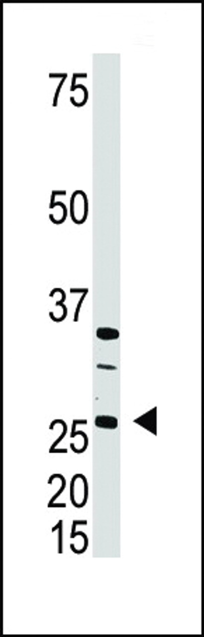 Antibody is used in Western blot to detect DKK4 in A375 cell lysate.