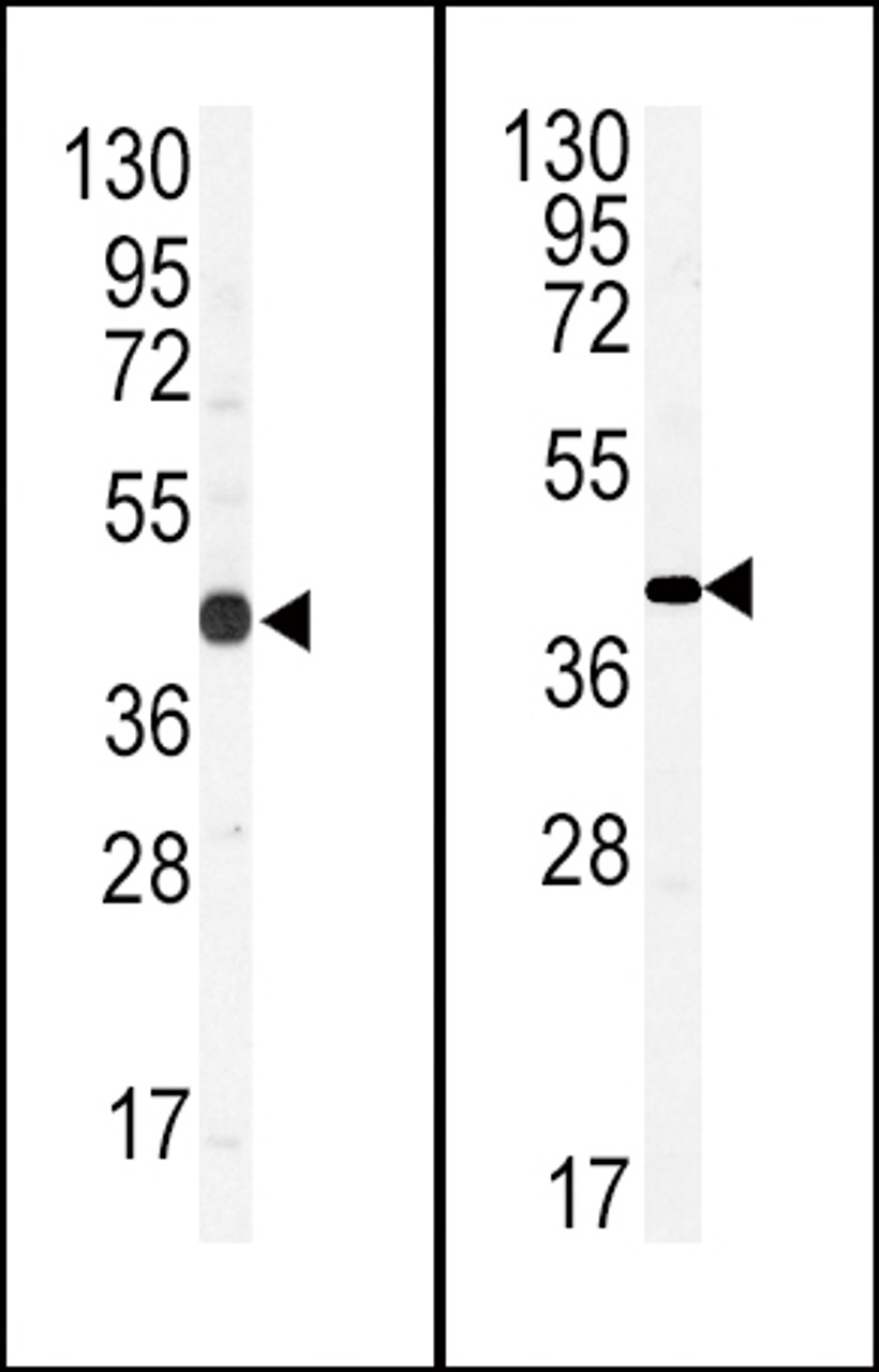 (LEFT) Western blot analysis of anti-GJA1 Antibody (N-term) in CEM cell line lysates (35ug/lane) . GJA1 (arrow) was detected using the purified Pab. (RIGHT) Western blot analysis of hGJA1-N121.Connexin in mouse brain tissue lysates (35ug/lane) .GJA1 (arrow) was detected using the purified Pab.